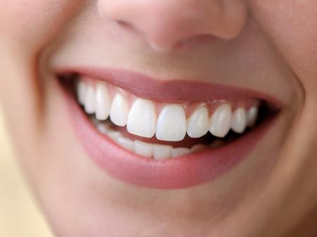 dentes-brancos-sorriso-bonito-1599583111401_v2_450x337