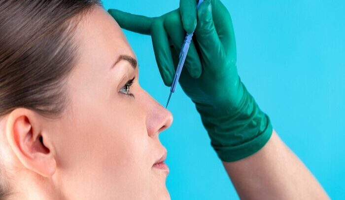 rinoplastia-700x413 rinoplastia-700x413