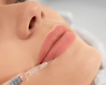 6 coisas sobre preenchimento labial que você precisa saber